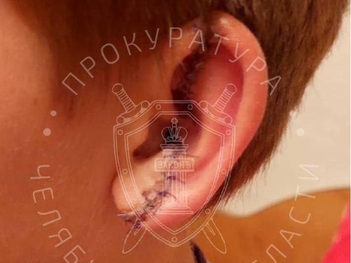 Получил разрыв селезенки и травмы уха: в Челябинске с чиновников взыскали 2 миллиона за травму ребенка