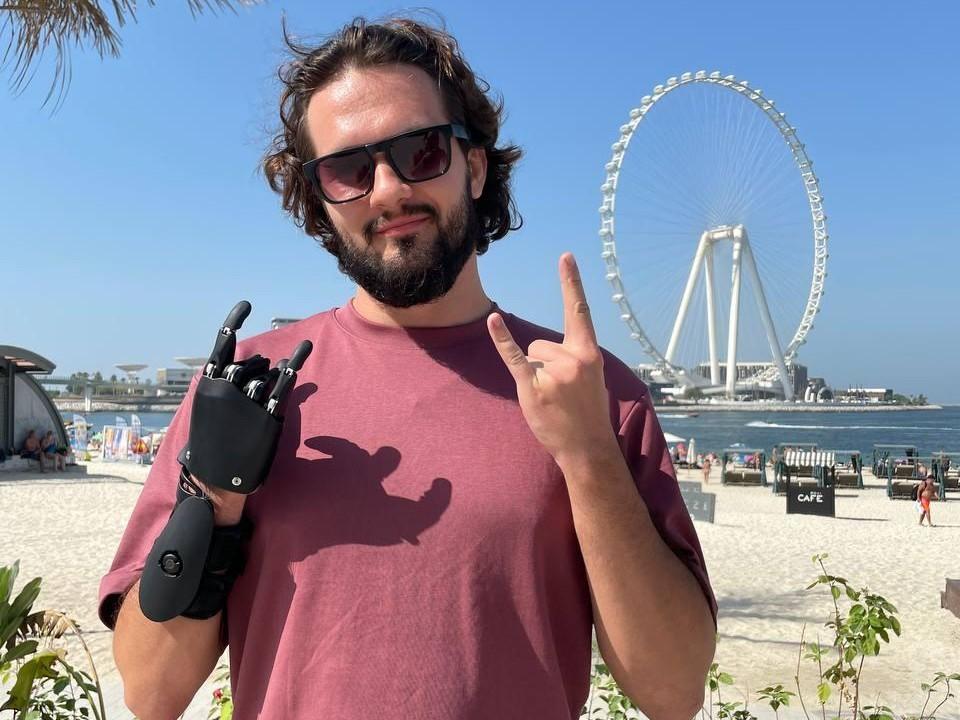Доказывал, что рука не отрастет. 27-летний программист показал, как живет с киберпротезом  его история