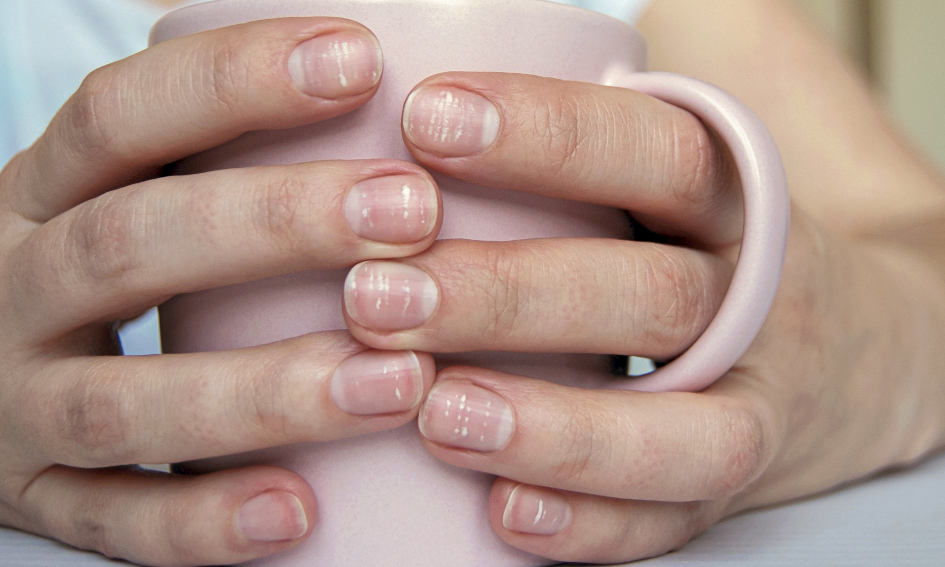 Бороздки на ногтях: причины и правильный уход