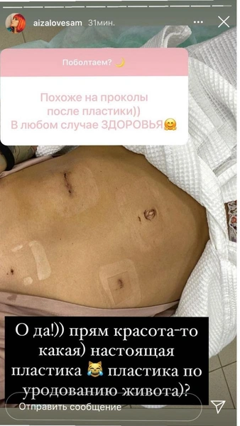 Айза после операции