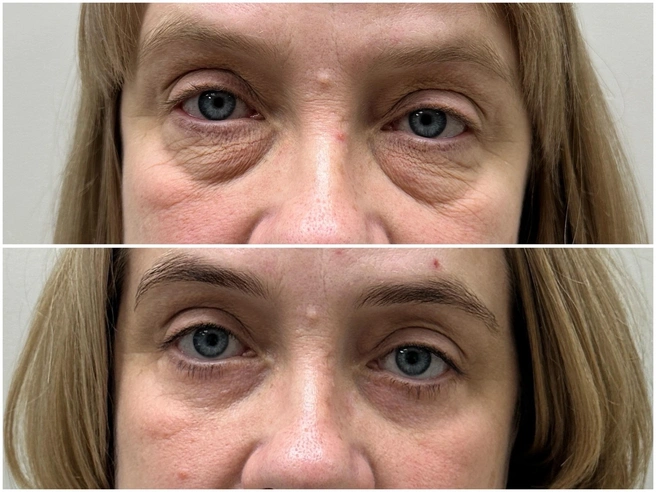 На втором снимке взгляд женщины после операции через 8 месяцев | Источник: Евгений Олейник