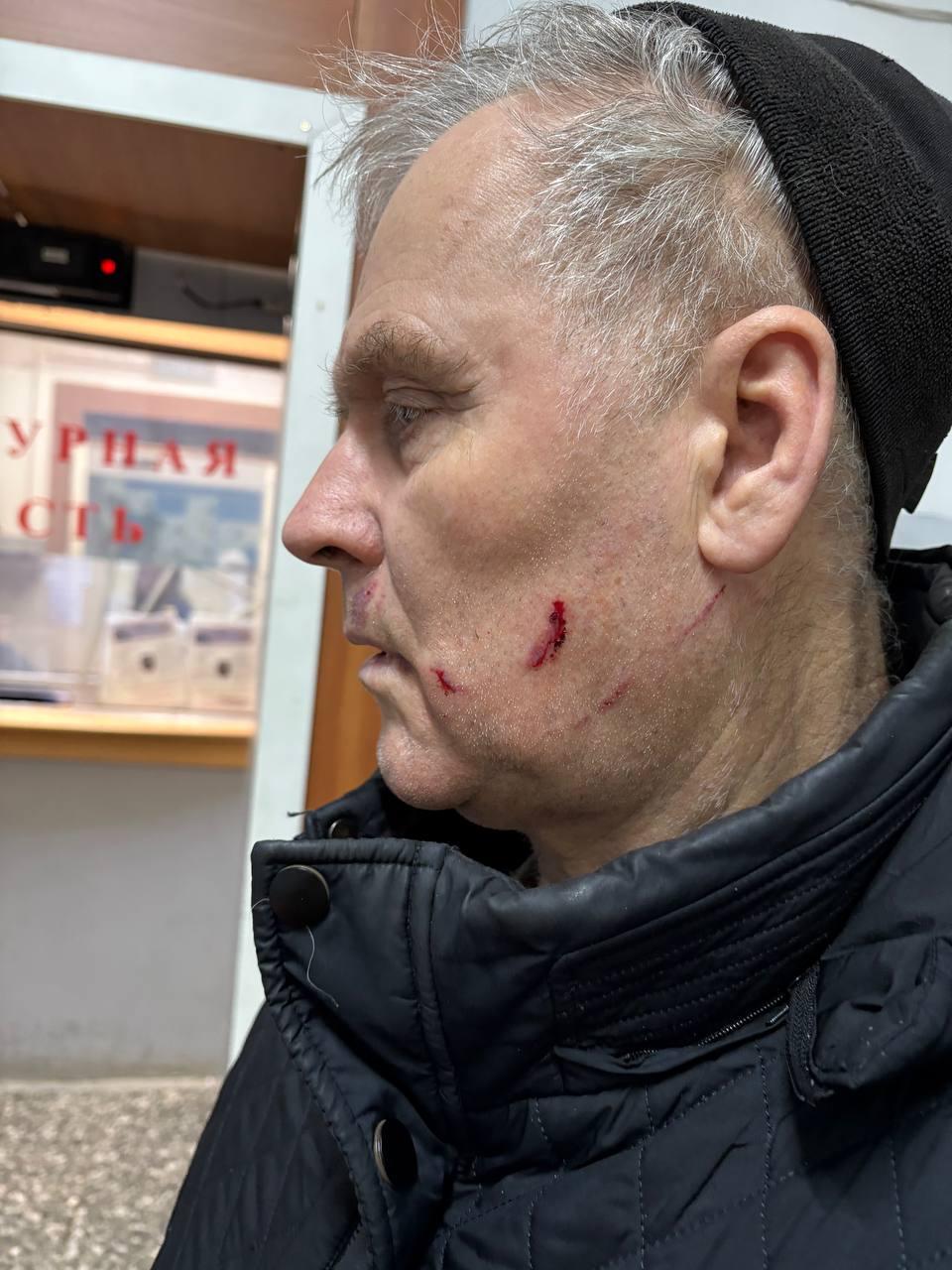 «Толкнул беременную с лестницы». На Урале соседи заявили, что пенсионер зарабатывает на разборках с…