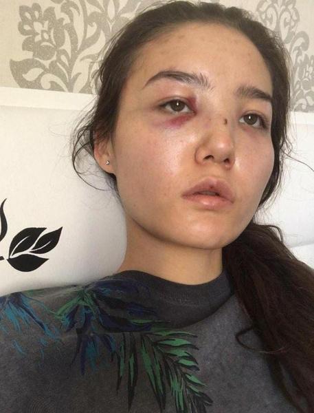 Сакен часто поднимал руку на Карину, и она вынуждена была рассказать обо всем широкой публике