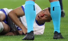 Киллиан Мбаппе получил травму на Евро-2024: когда он вернется к игре?