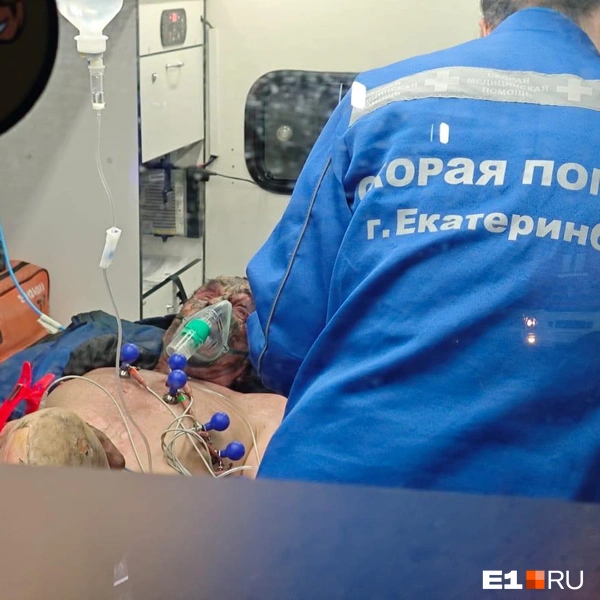 30% поверхности тела мужчины поражены ожогами | Источник: ИА Ночные Новости