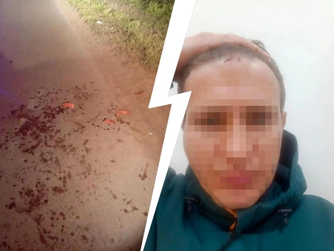 Супруга пострадавшего описала детали нападения. | Источник: читатели V1.RU