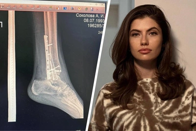 СК проверяет, как друг сломал ногу пермскому врачу