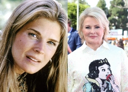 Кэндис Берген — мама новой главы американского Vogue. Почему о ней говорят все?