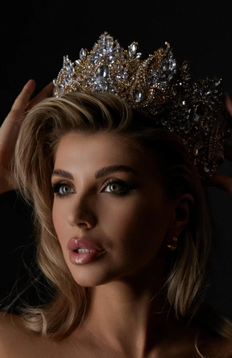 Обвинения в пластике Анастасия пропускает мимо ушей | Источник: Анастасия Белик / Личный архив