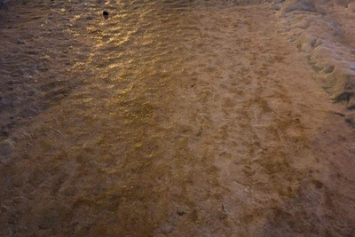 Over 20 frostbite cases, 1000+ injuries from black ice in Voronezh