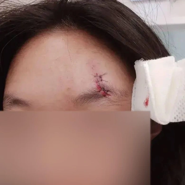 Произошедшее одна из женщин, которых мать Кати обвиняет в избиении, назвала «недоразумением» | Источник: предоставлено редакции семьей пострадавшей