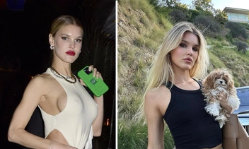 «До и после»: самая сексуальная ангел Victoria's Secret удалила грудные имплантаты и показала результат