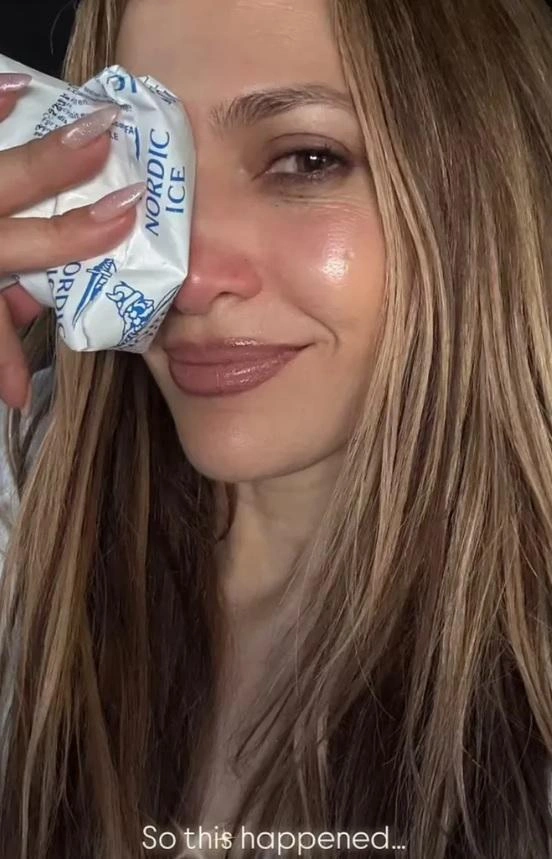 Дженнифер рассказала о случившемся подписчикам | Источник: jlo / Instagram.com (экстремистская организация, деятельность запрещена на территории РФ)