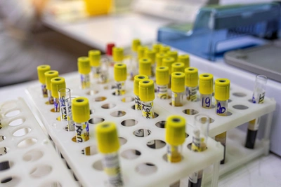 What Makes Nipah Virus Dangerous and How to Protect Against It