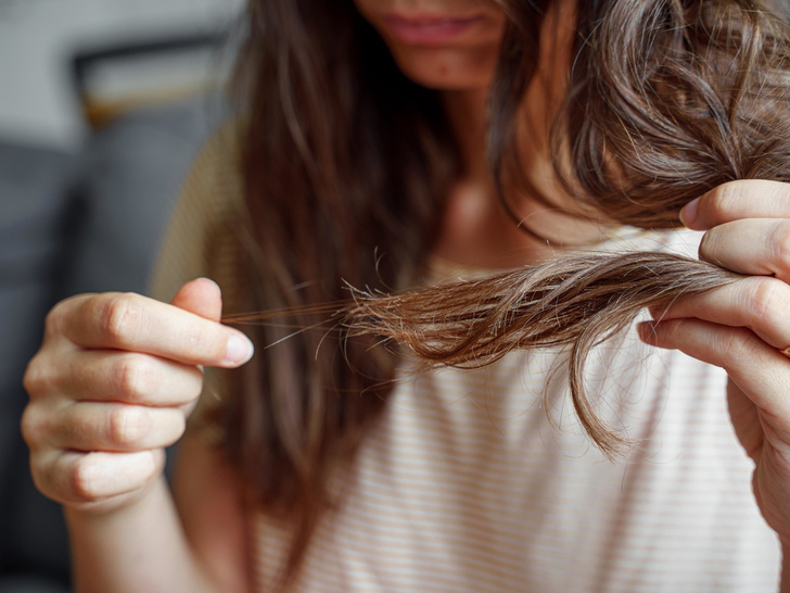 О чем молчат врачи: 6 популярных продуктов, которые приводят к выпадению волос