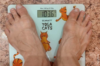 В облбольнице провели свыше 20 операций по лечению ожирения