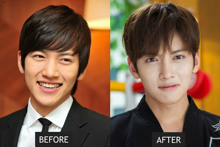 Ты не поверишь этим фото: 10 корейских звезд до и после пластики