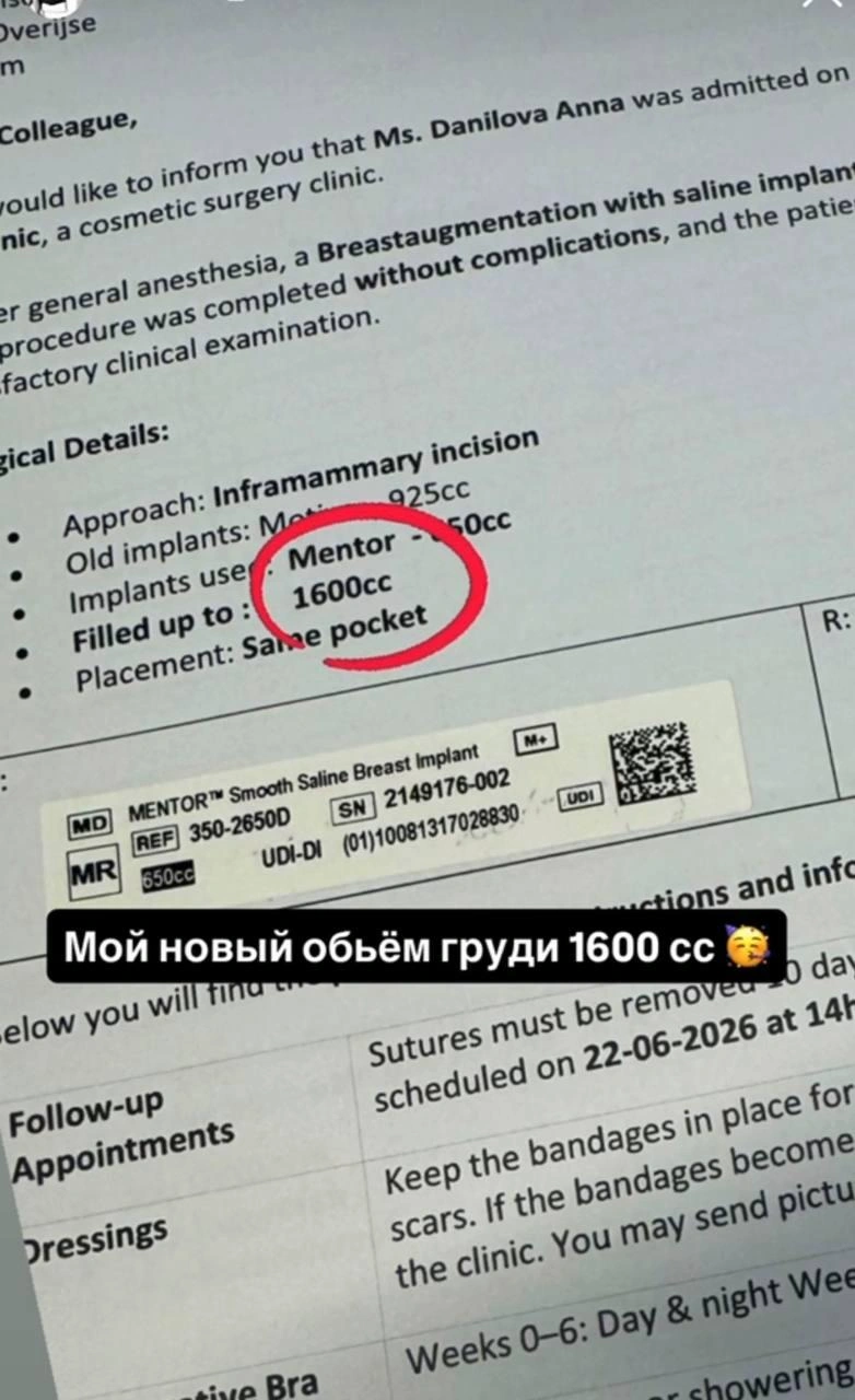 Анна сделала себе экстремально большую грудь | Источник: annushka_da / Instagram.com (соцсеть запрещена на территории РФ)