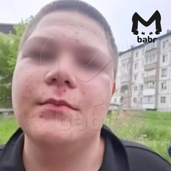 Одному из мальчиков попали по лицу | Источник: Babr Mash / Telegram