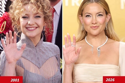 Кейт Хадсон: гены или доктора?