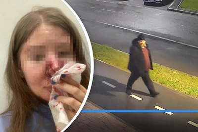 Stranger breaks woman's nose for rejecting kiss in Tyumen