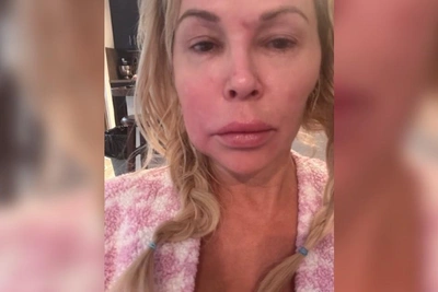 Загадка болезни Бренди Гланвиль: разрыв импланта