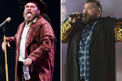 Teddy Swims обгорел на Coachella и едет на Stagecoach