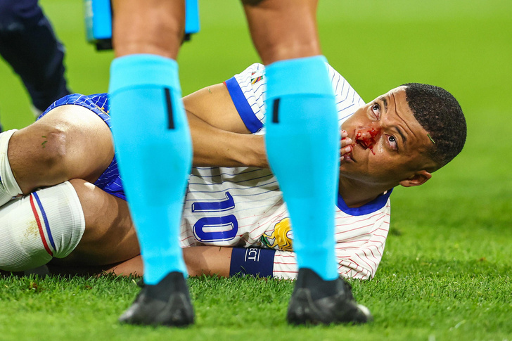 Капитан сборной Франции по футболу сломал нос в матче с Австрией