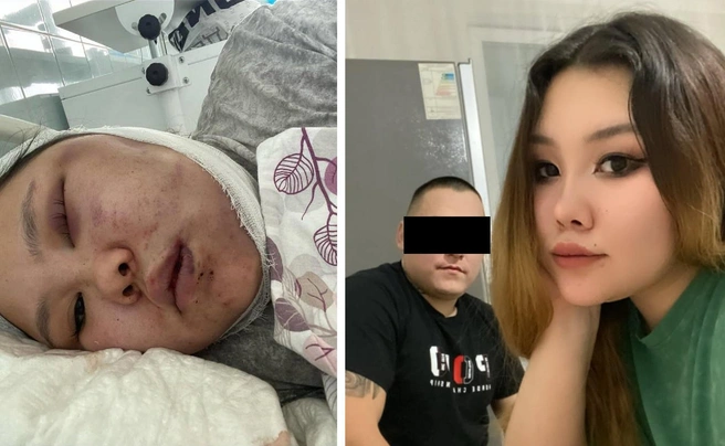 Татьяна после очередного избиения попала в больницу | Источник: _tatishka_17_07 / Instagram (экстремистская организация, деятельность запрещена на территории РФ)