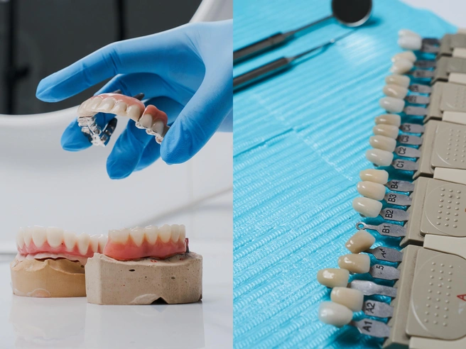 Пациентам клиники предлагают различные техники восстановления зубного ряда | Источник: «Стоматологическая практика Евгения Олеговича Золотаева»