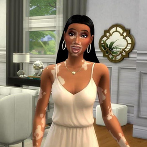 В культовой игре Sims 4 появились персонажи с витилиго
