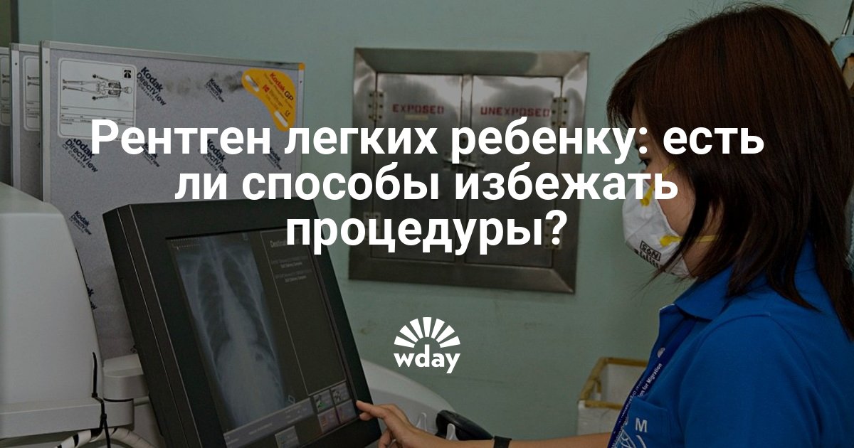 Сколько раз в год можно делать рентген взрослому человеку отзывы врачей