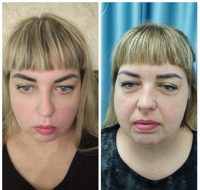 В личном архиве фотографий до и после похудения не так много, зато прогресс легко отследить по видео блогерши, у которой снимается Екатерина | Источник: Екатерина Веприкова 