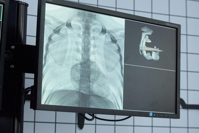 Аппарат поможет выявлять проблемы с сосудами, сердцем и мозгом у больных | Источник: Дмитрий Толстошеев / MSK1.RU