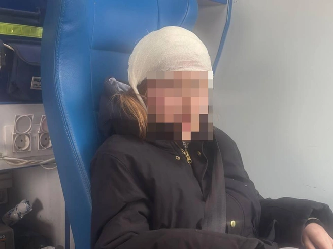 Ребёнку потребовалось наложение швов на голову. Госпитализация, по имеющимся данным, не понадобилась. | Источник: читатели V1.RU