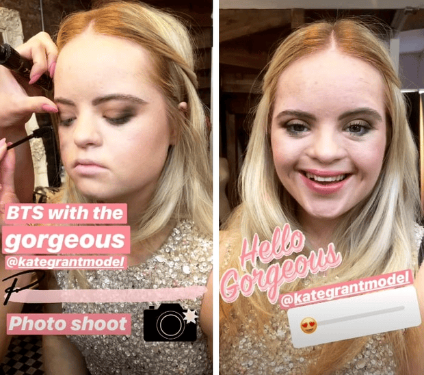 Фото №1 - Девушка с синдромом Дауна стала рекламным лицом Benefit Cosmetics