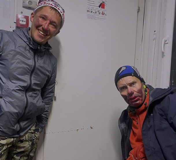 Жуткие фото альпинистов, выживших на Эльбрусе