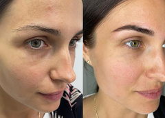 До и после: как меняется внешность девушек после работы мастеров-бровистов