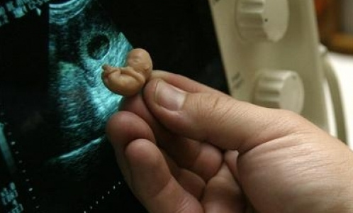 За аборты врача могут посадить на 8 лет