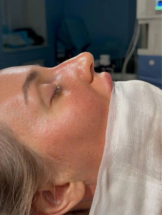 Нос Александры Селивановой до операции