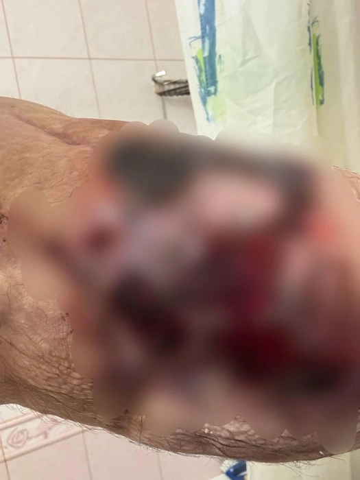 Рука выглядит пугающе | Источник: Кирилл Терешин / Vk.com