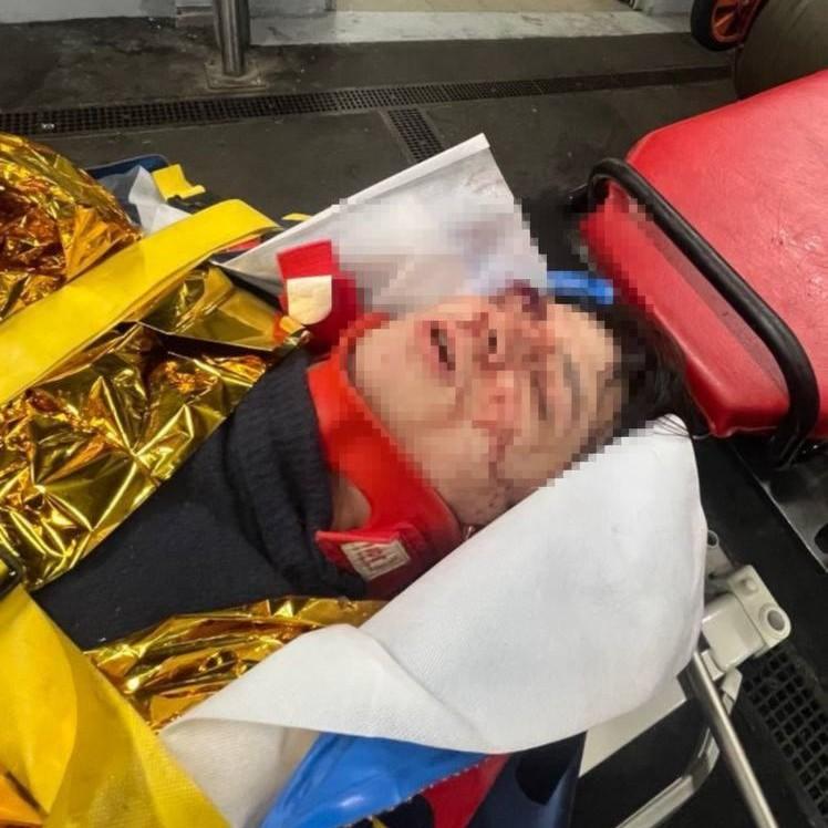 Рэпер Vacio выпал с третьего этажа в Париже — он в реанимации, состояние критическое