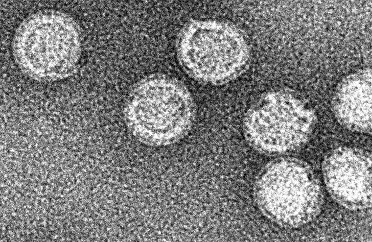 Пожиратель мозга: что мы знаем о клещевом энцефалите и как его избежать