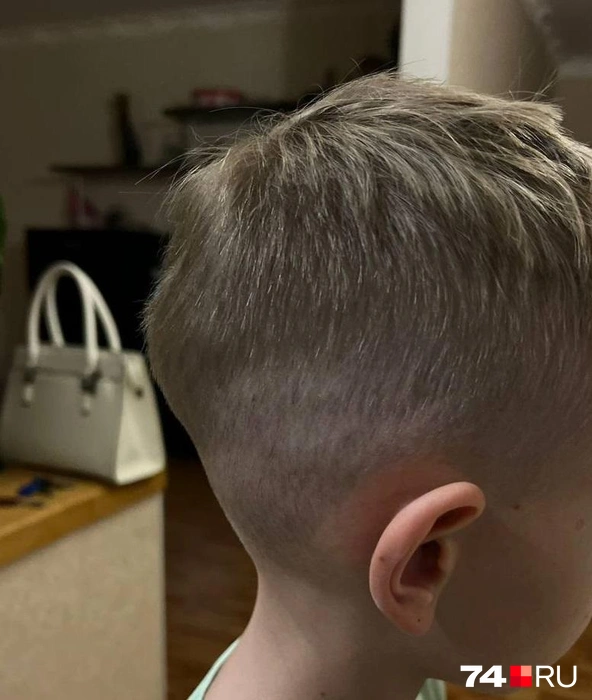 После падения у Никиты на голове была шишка  | Источник: читатель 74.RU