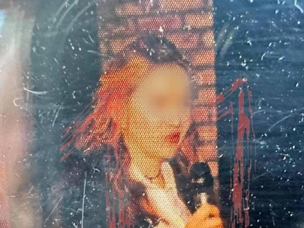 Девушка, вручившая военкору Татарскому статуэтку со взрывчаткой, находится в больнице