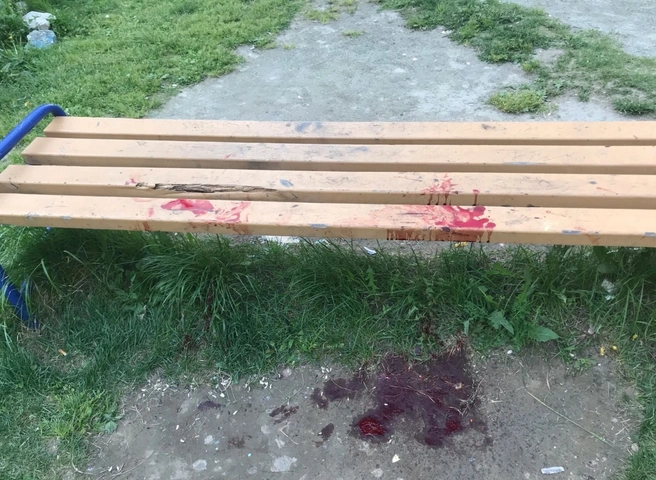 В Нижнем Тагиле пятилетний мальчик убил девочку, выбросив из окна смеситель | ya62.ru