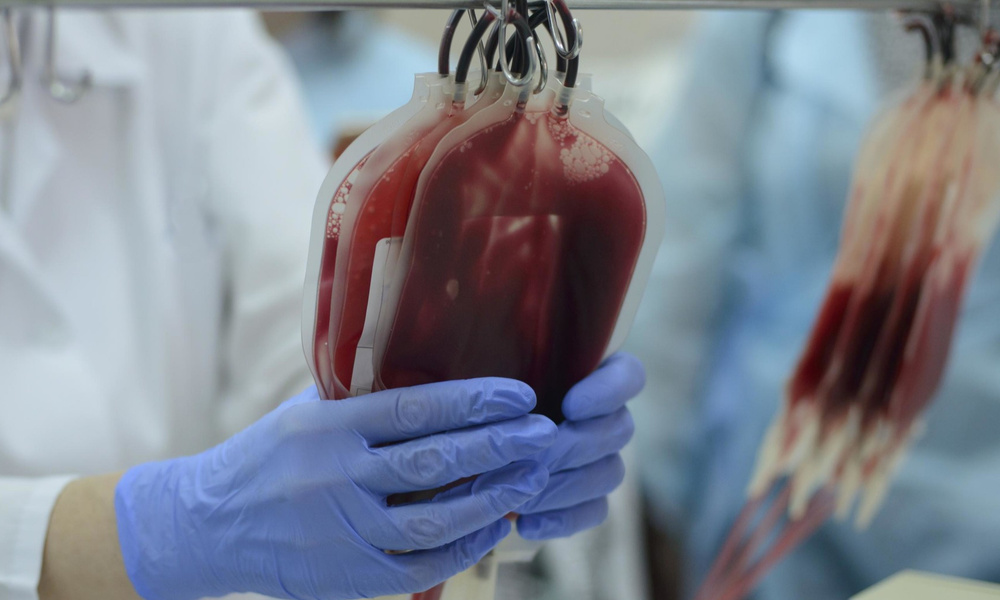 Отец запретил дочери становиться донором костного мозга для брата и получил массовую поддержку в Сети