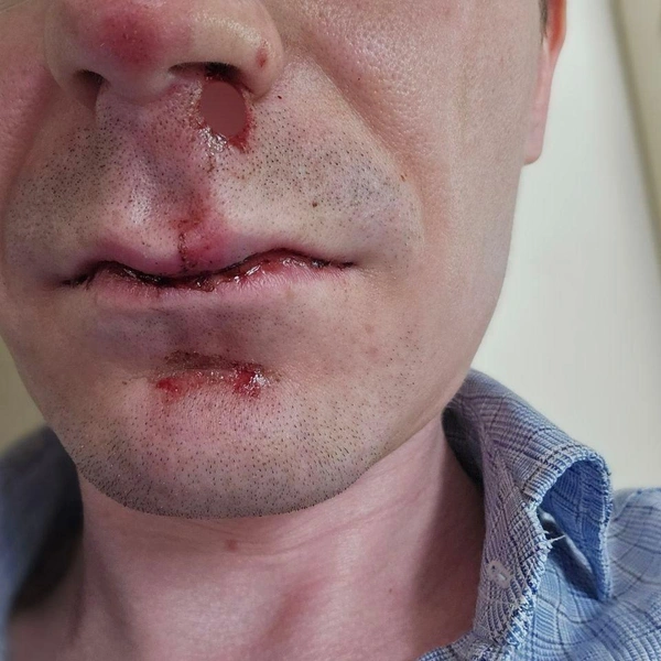 Мужчин били по лицу… | Источник: «МОЙ ГОРОД&nbsp;— ПЕРМЬ!» / Vk.com