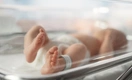 Новорожденная девочка с редким синдромом Ундины провела в больнице 1,5 года