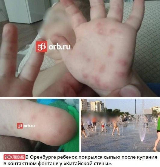 Последствия купания | Источник: 56.orb / t.me